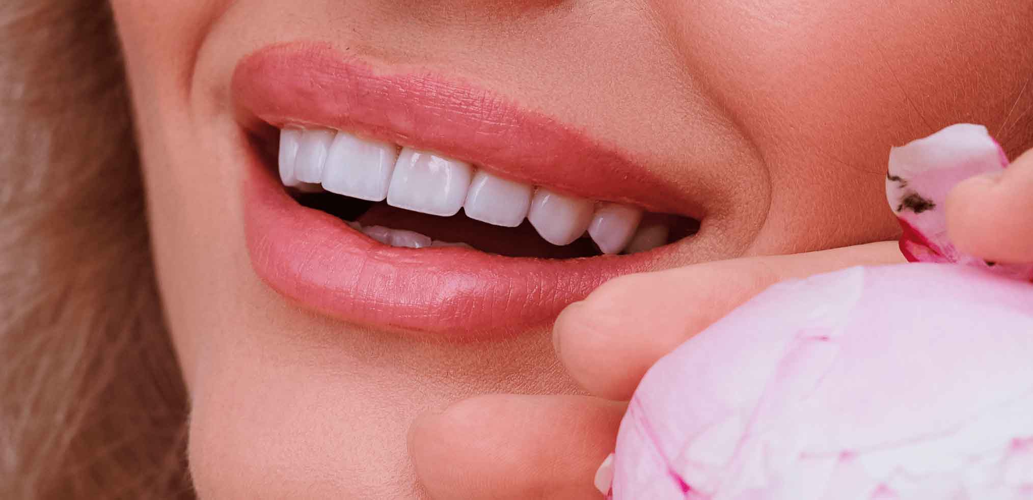 Вініри на зуби