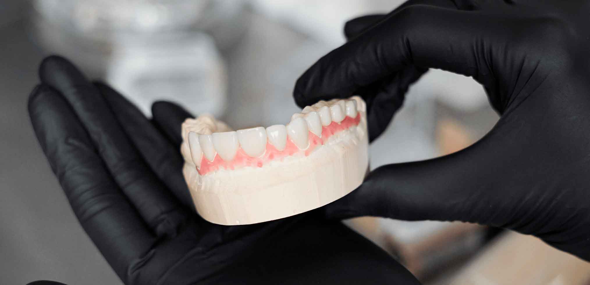 Зубні протези